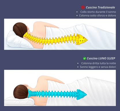Cuscino Ergonomico LunoSleep™ –